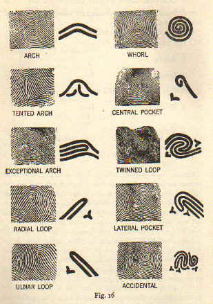 Classification of dernmatoglyphic patterns as used within forensic science